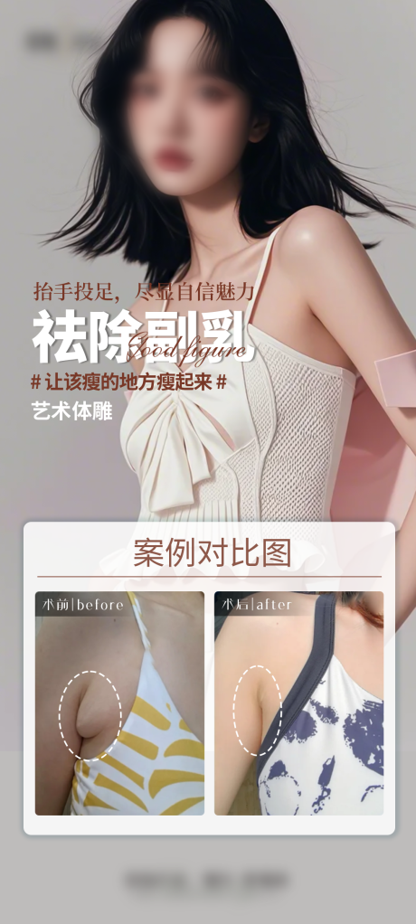 源文件下载【享设计】搜索编号：52330029381071089【医美祛除副乳案例海报】