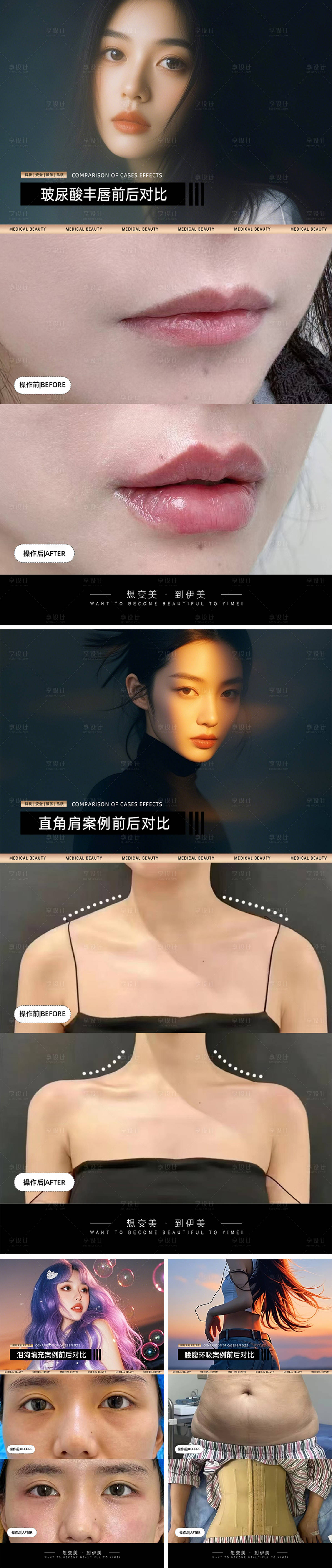 源文件下载【享设计】搜索编号：68640029830267266【医美案例对比模板】