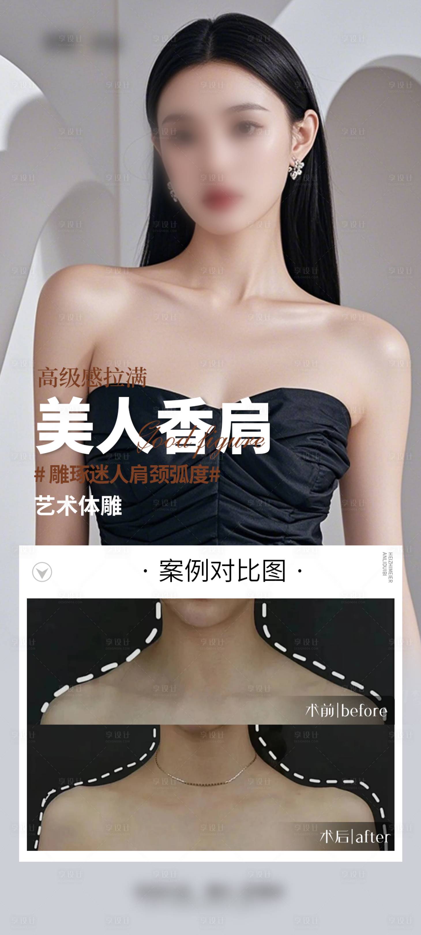 源文件下载【享设计】搜索编号：41290029491398994【医美肩案例海报】