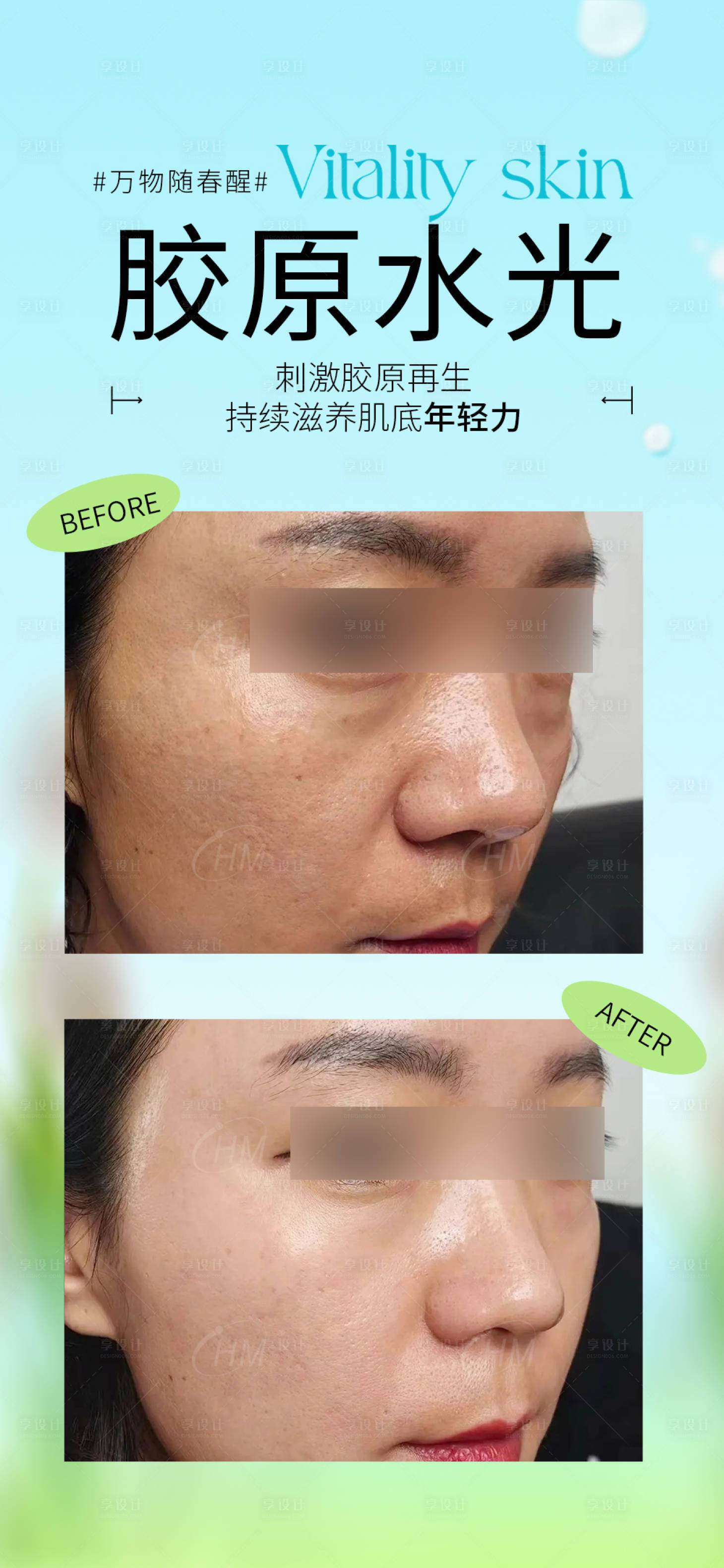 源文件下载【享设计】搜索编号：82090029715504290【胶原水光案例】