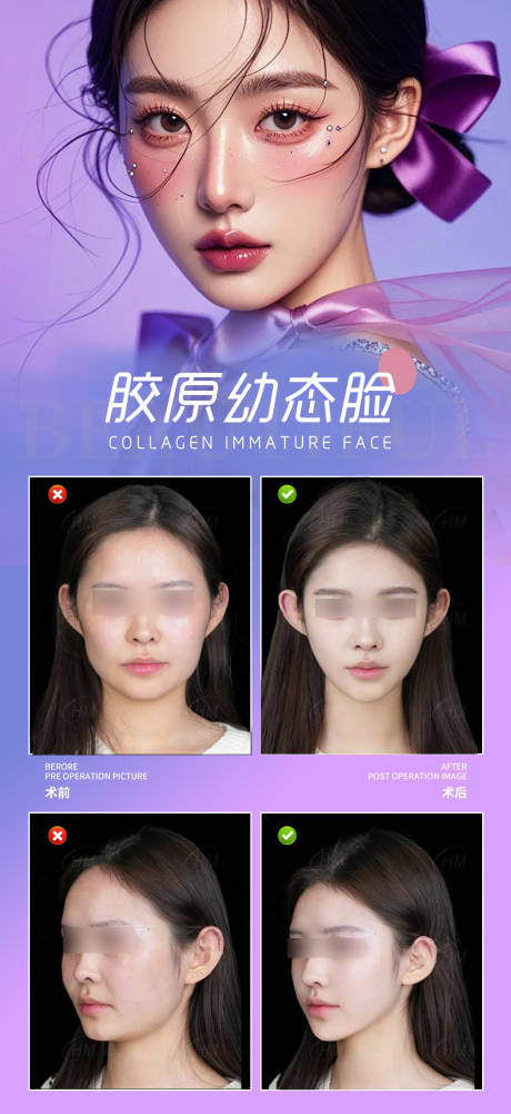 源文件下載【享設計】搜索編號：90410029335554760【膠原幼態臉案例海報】