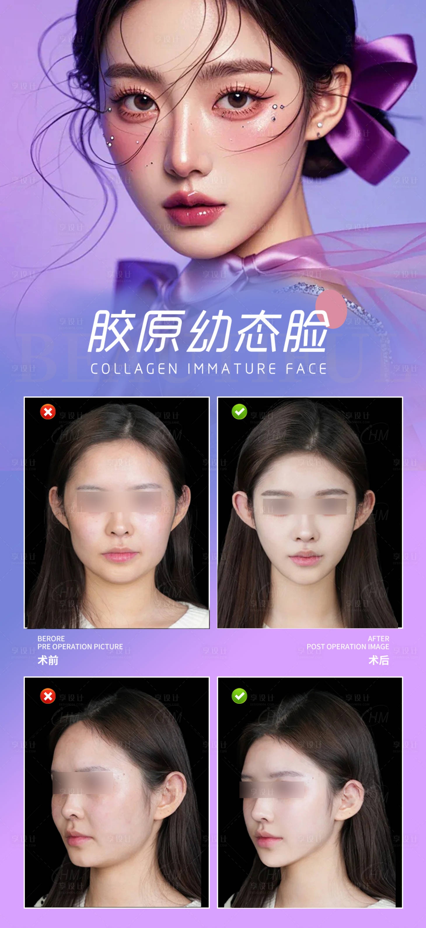 源文件下載【享設(shè)計(jì)】搜索編號(hào)：90410029335554760【膠原幼態(tài)臉案例海報(bào)】