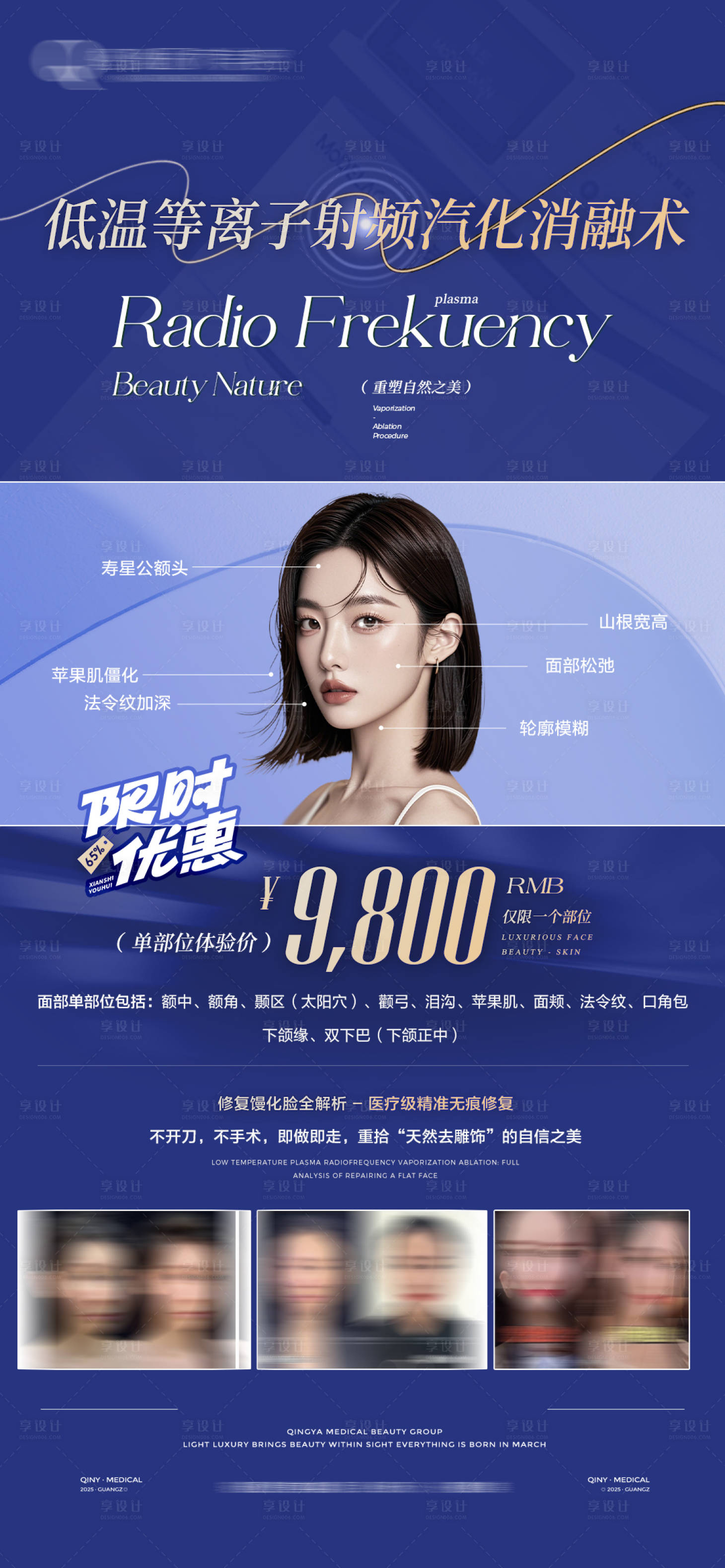 源文件下載【享設計】搜索編號：90040029475131015【消融術介紹海報】