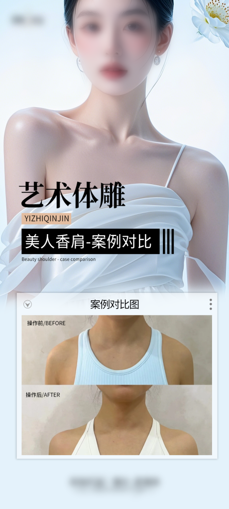 源文件下载【医美肩案例海报】编号：78320029325266322