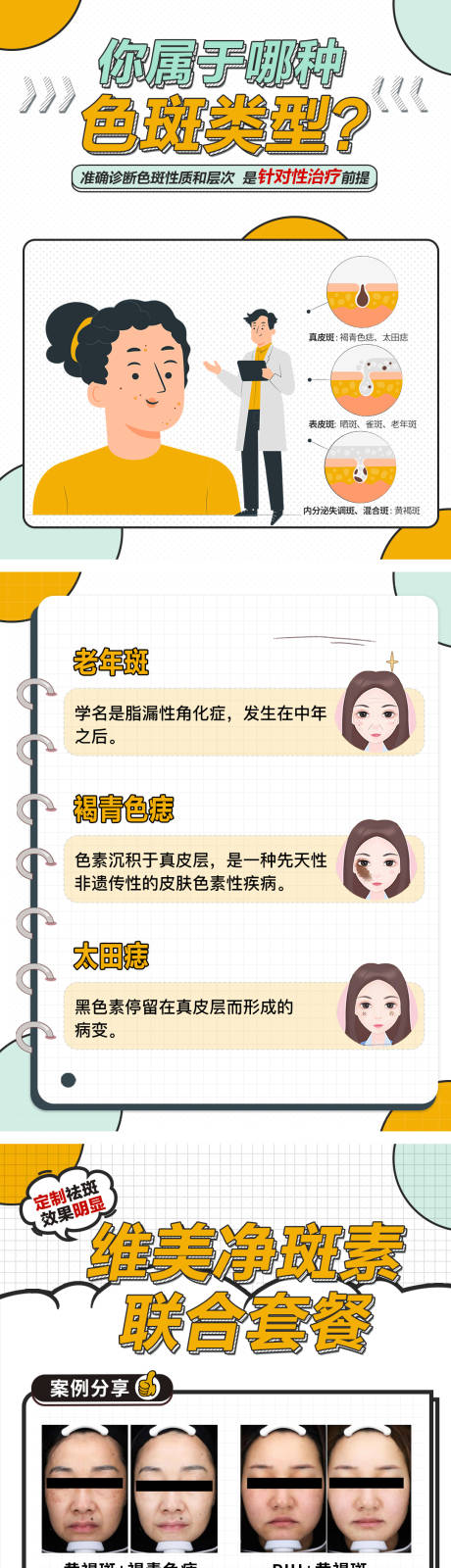源文件下载【医美祛斑科普长图海报】编号：92720029598164758