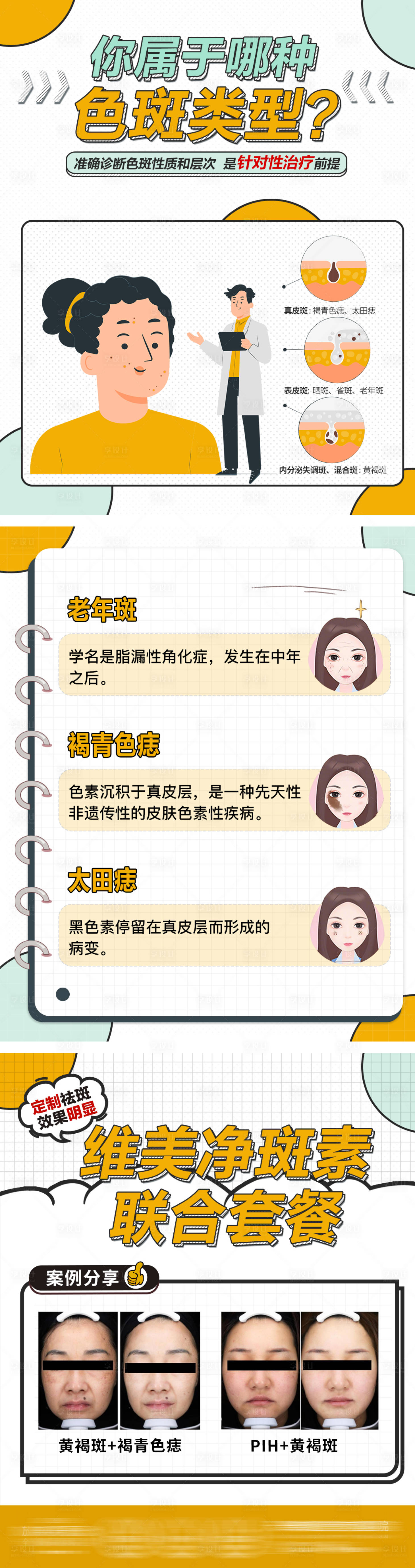 源文件下載【享設計】搜索編號：92720029598164758【醫美祛斑科普長圖海報】