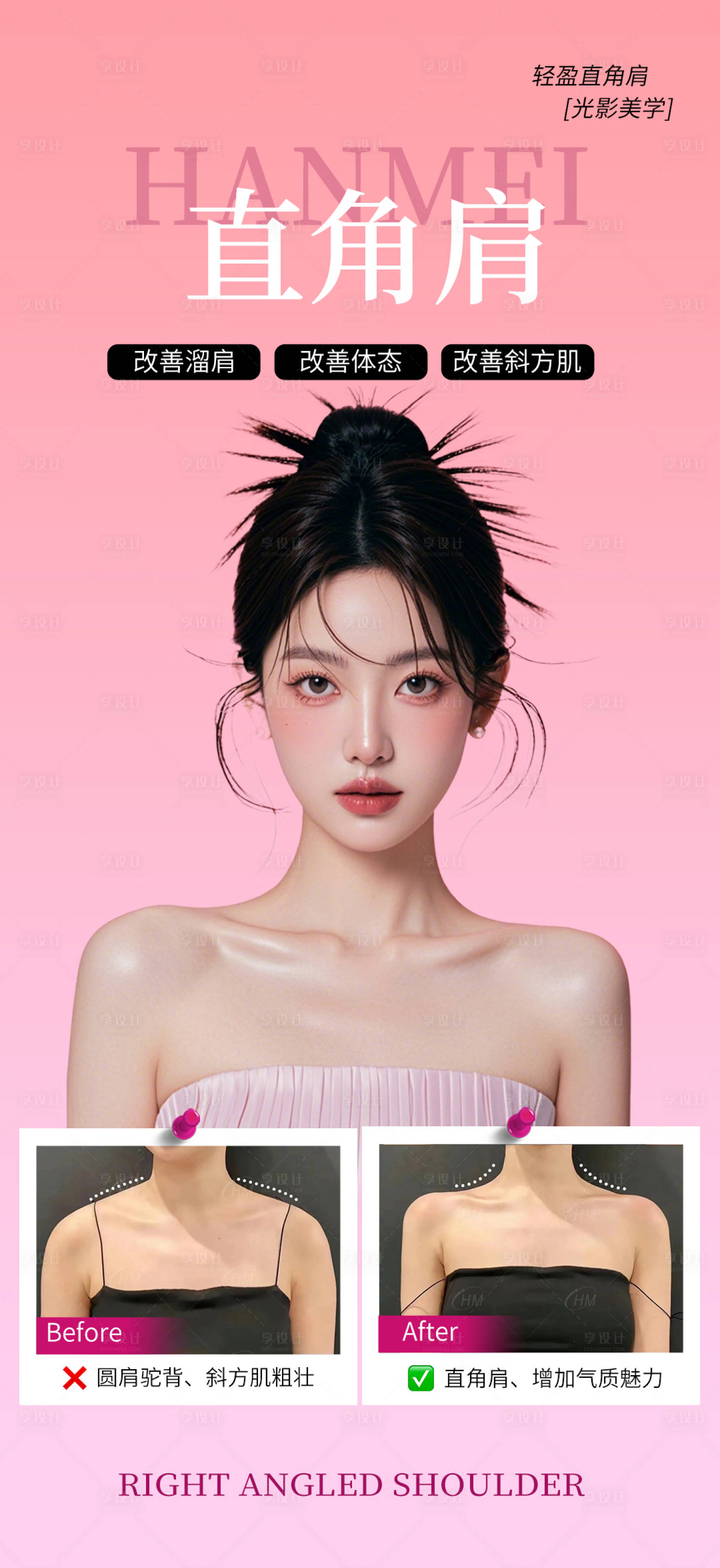 源文件下载【瘦肩针直角肩】编号：74630029802439520