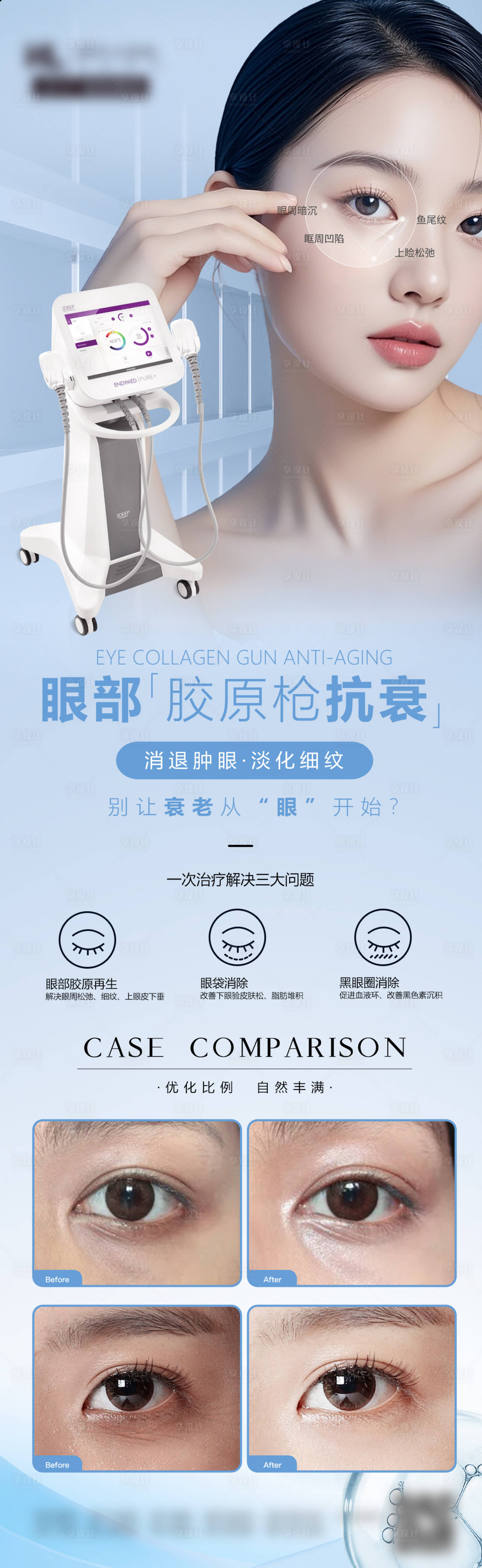 源文件下载【眼部抗衰胶原枪】编号：97180029248697294