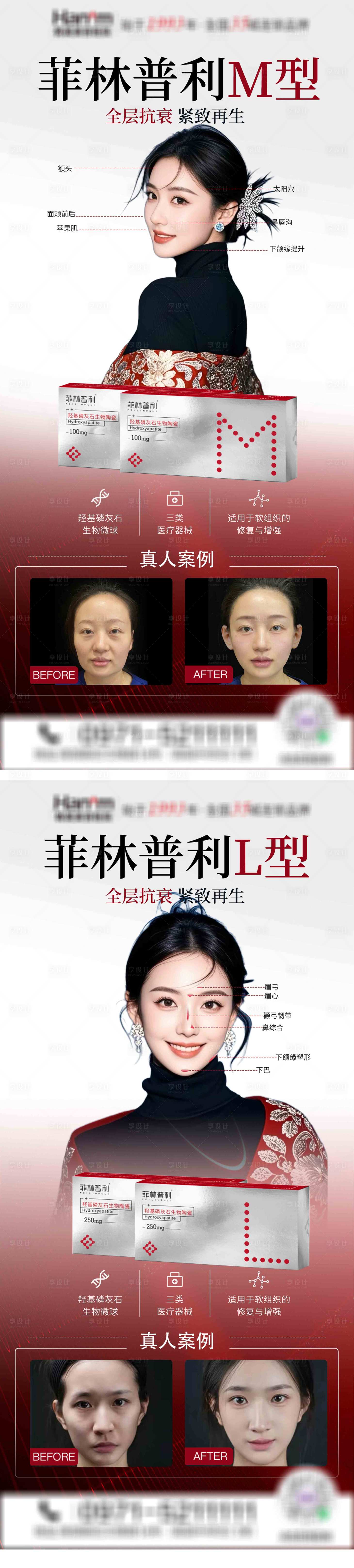 源文件下载【菲林普利海报】编号：68630029630029961