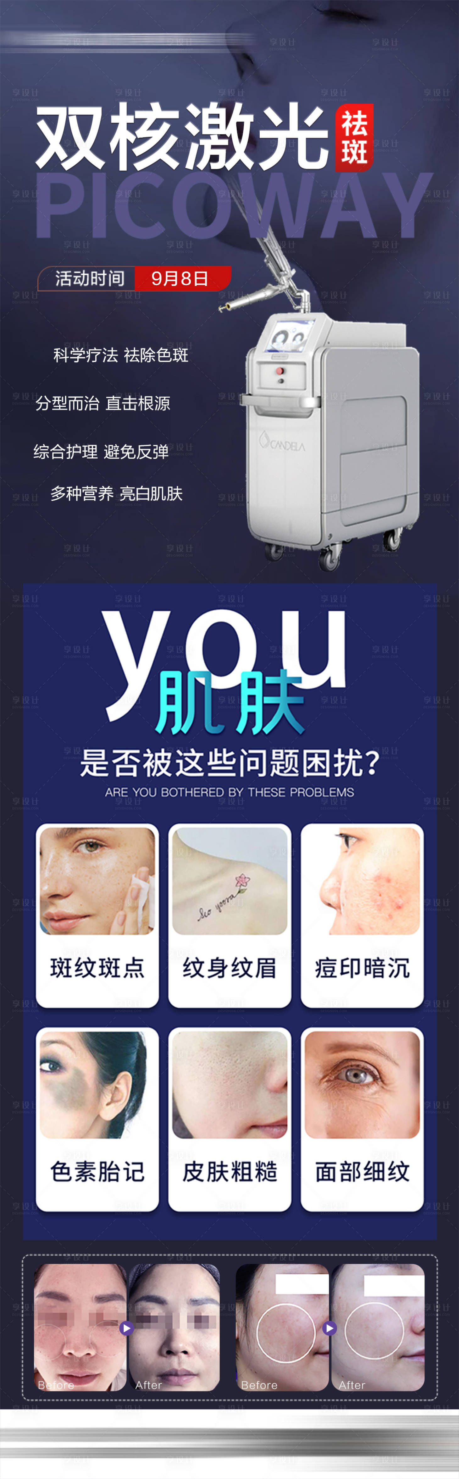 源文件下載【醫美超皮秒活動長圖】編號：82950029983923306
