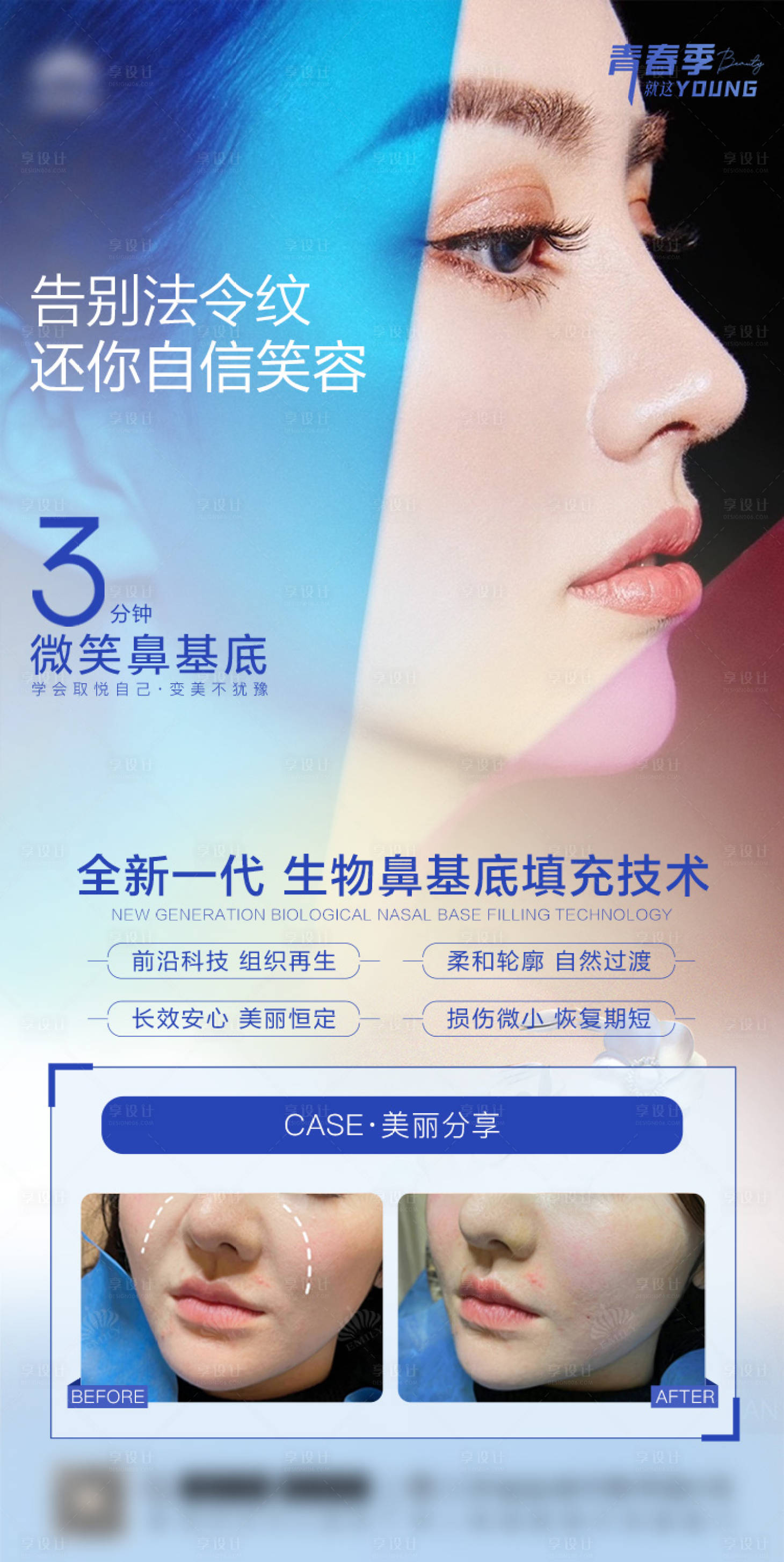 源文件下载【享设计】搜索编号：28880029984061427【医美3分钟微笑鼻基底】