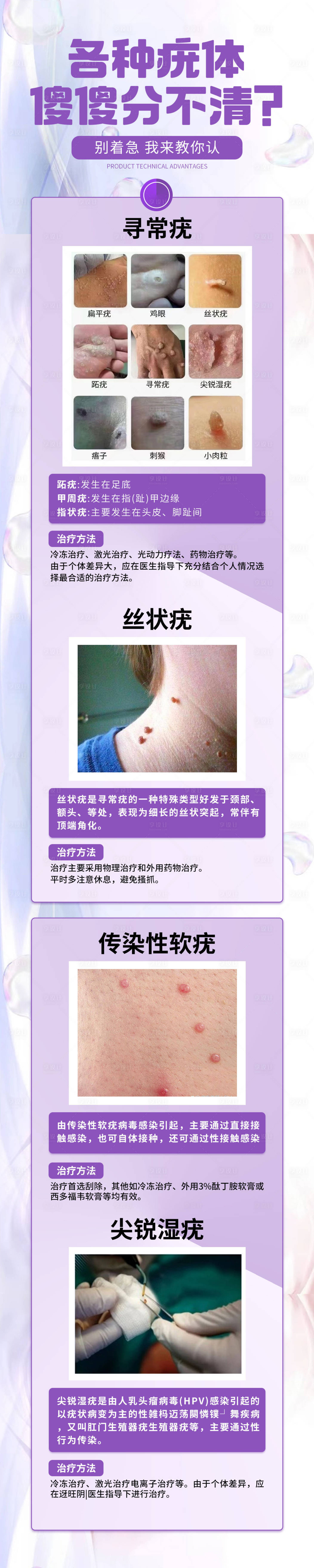 源文件下載【享設(shè)計】搜索編號：86230030053641617【疣體分類詳情頁】