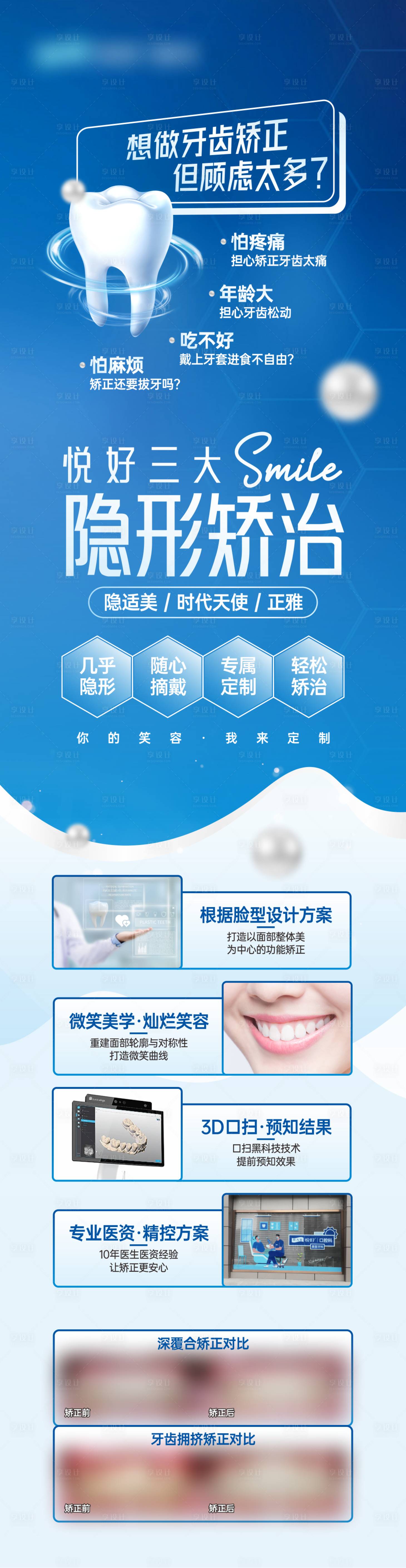 源文件下載【享設計】搜索編號：14480029916692581【藍—隱形矯正】
