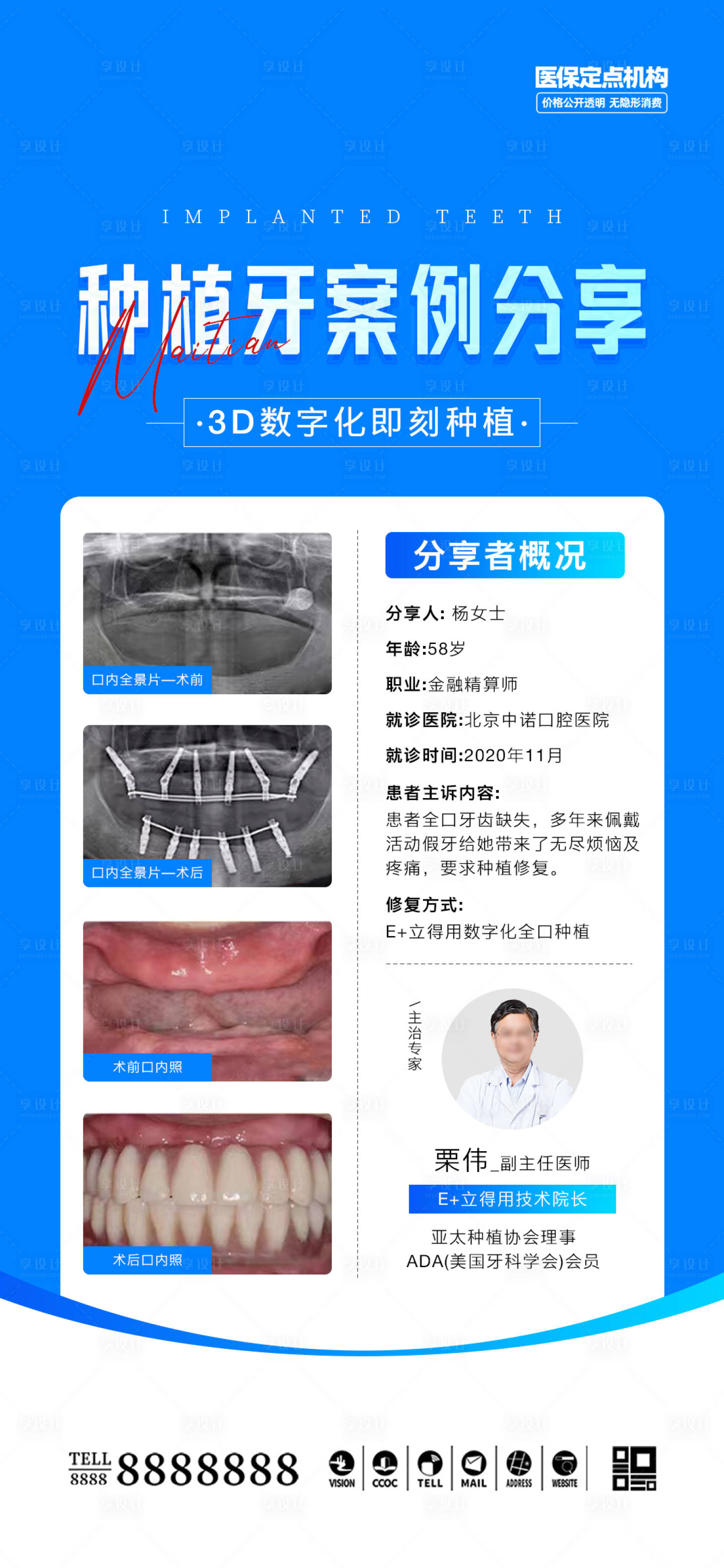源文件下载【口腔门诊种植牙案例海报】编号：20800030018205569