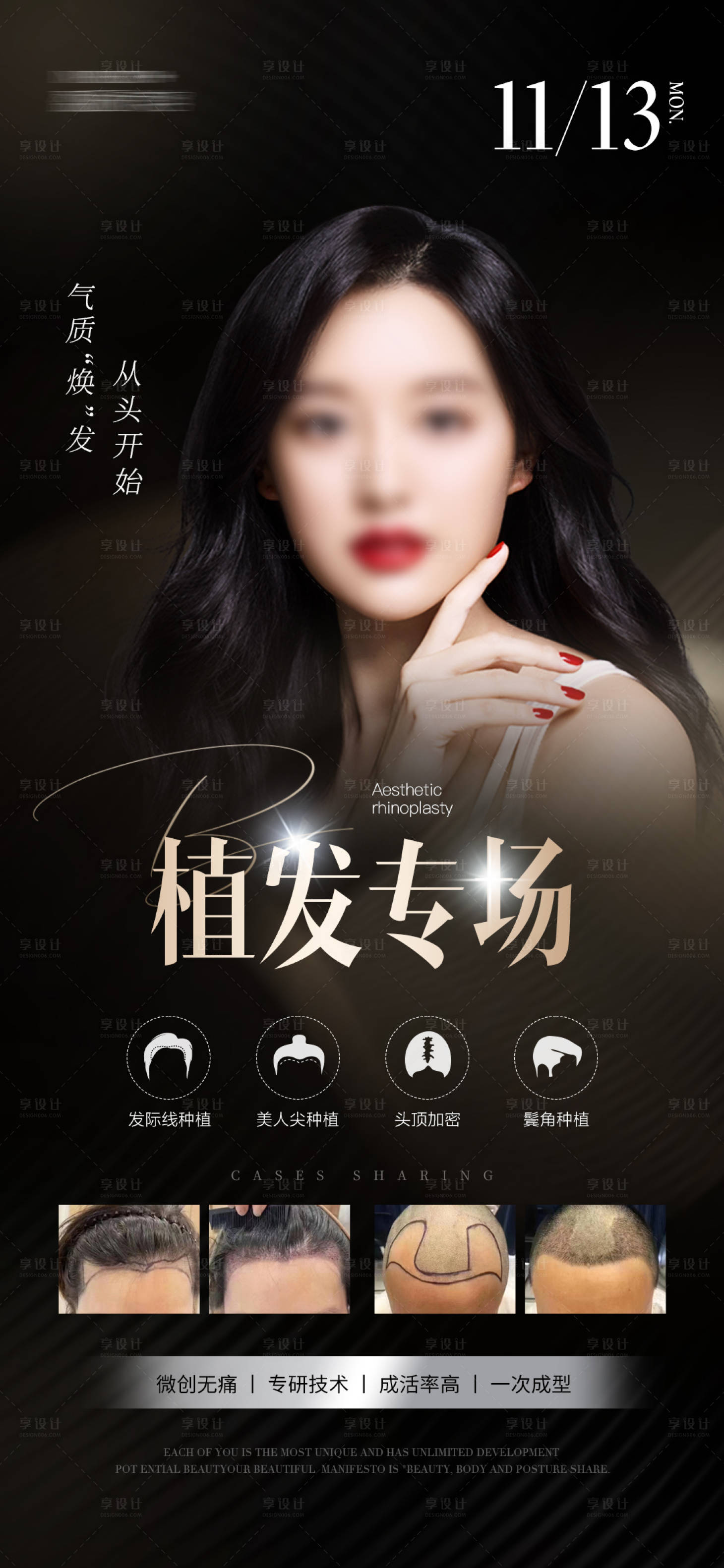 源文件下载【享设计】搜索编号：37960030502097823【植发专场】