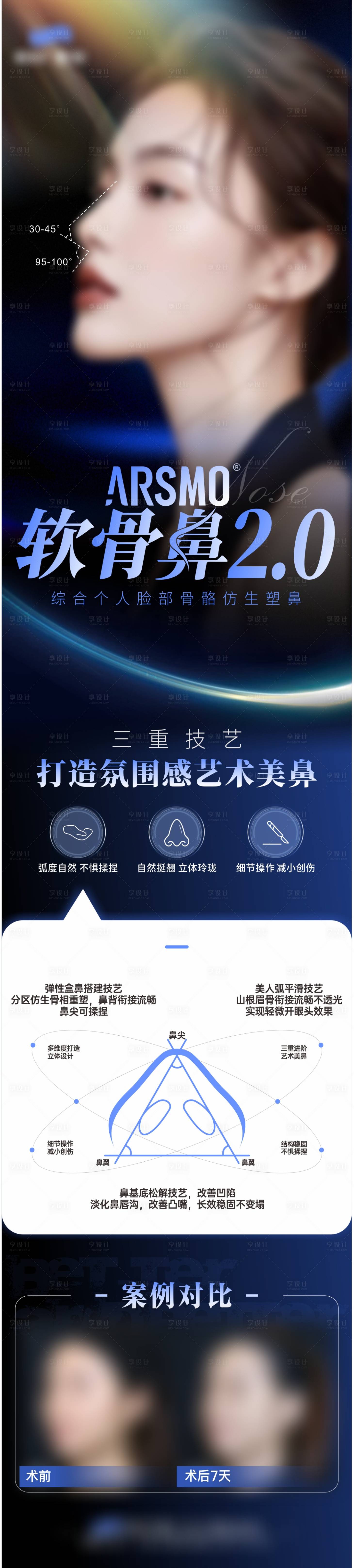 源文件下載【享設(shè)計】搜索編號：74540030111365635【軟骨隆鼻 】