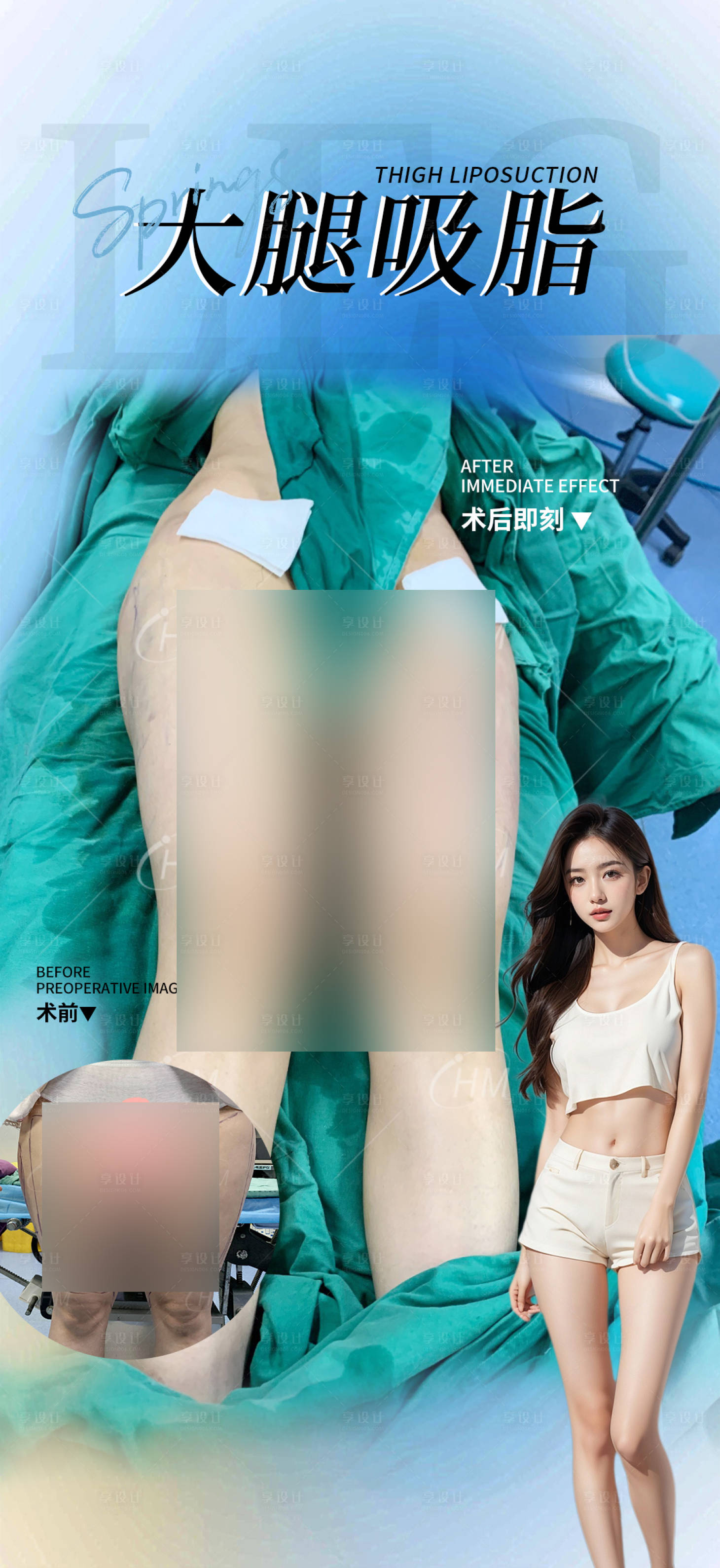 源文件下载【大腿吸脂案例宣传海报】编号：40310029928034024