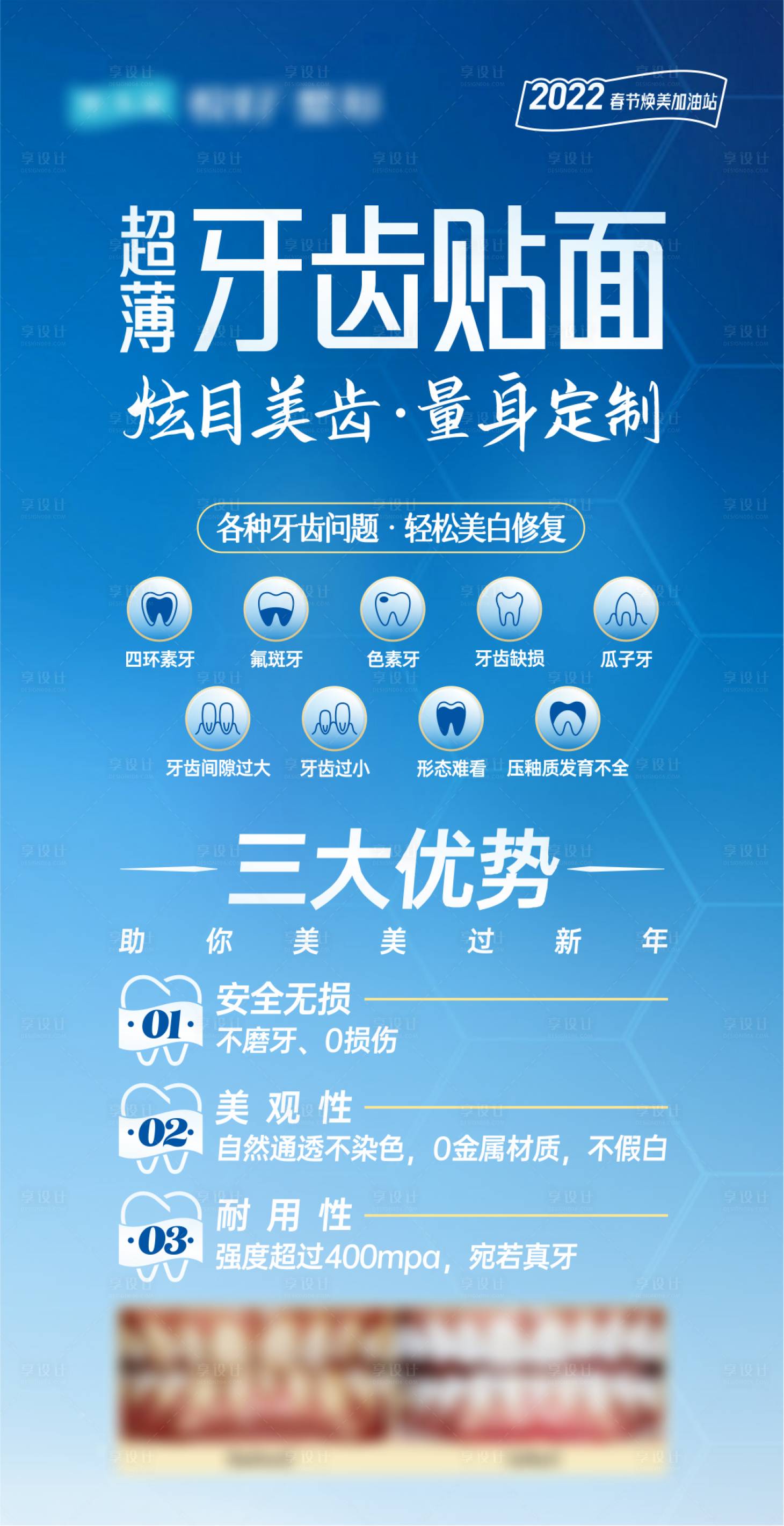 源文件下载【享设计】搜索编号：26410029916815893【牙齿贴面】