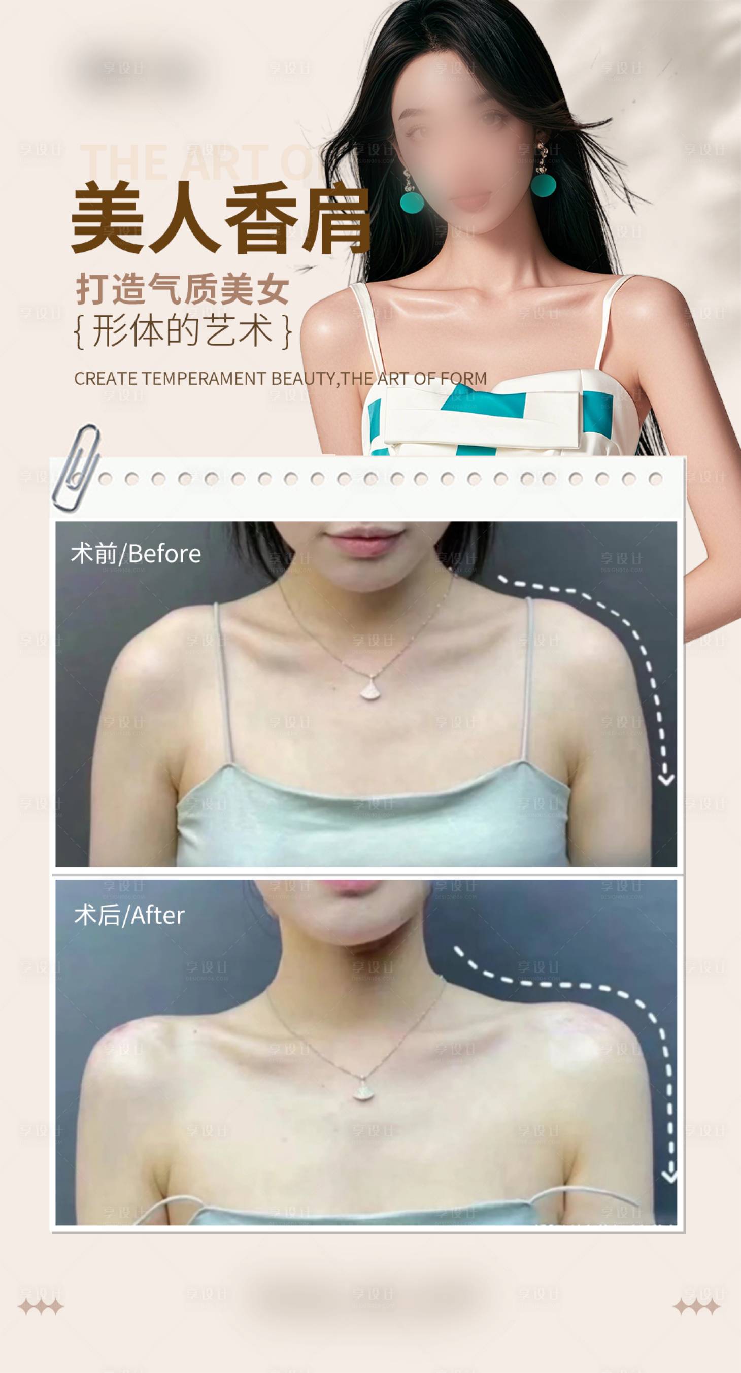源文件下載【享設(shè)計】搜索編號：58750030113772249【醫(yī)美美人肩案例海報】