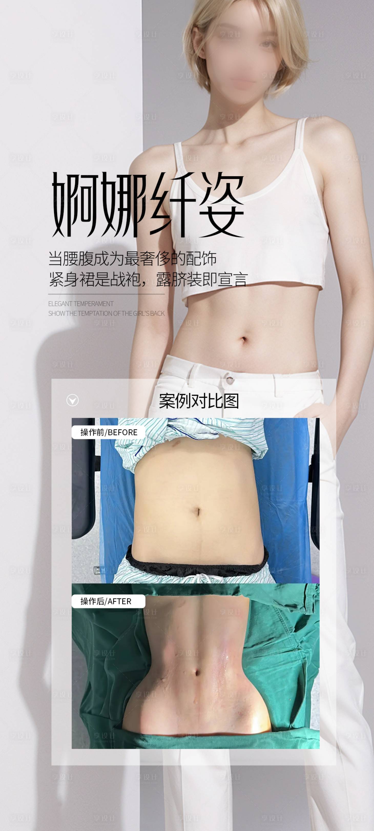 源文件下载【享设计】搜索编号：22410030446171277【医美腰腹案例海报】