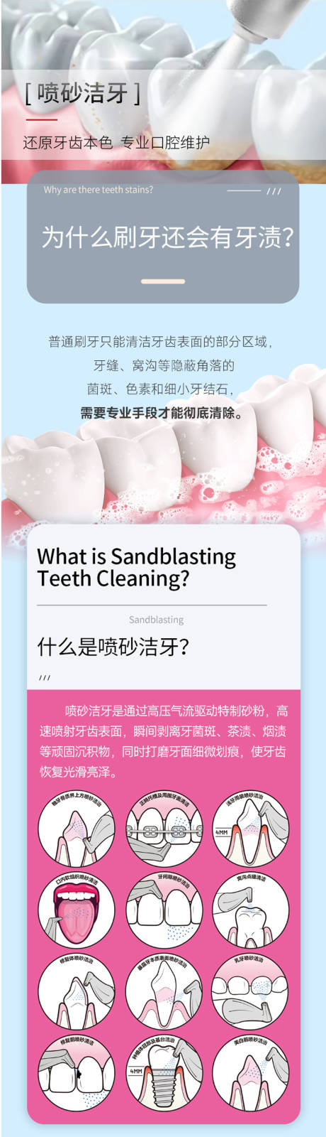 源文件下载【享设计】搜索编号：74540030180325633【口腔喷砂洁牙洗牙详情页】