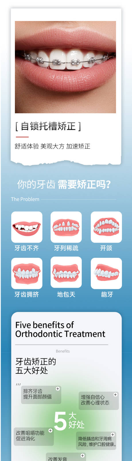 源文件下載【享設(shè)計(jì)】搜索編號(hào)：18910030192431272【成人自鎖托槽正畸詳情頁(yè)】