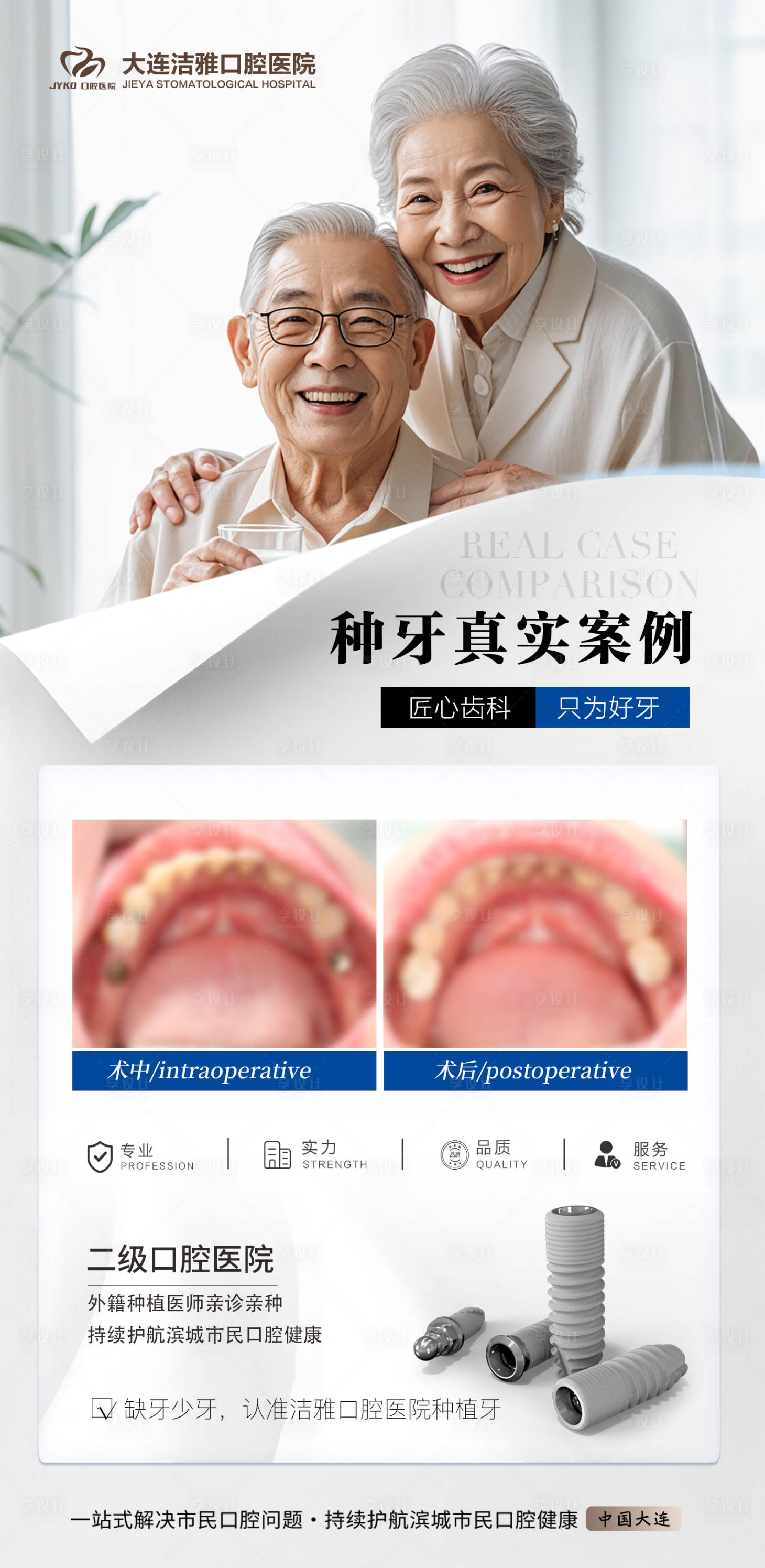 源文件下载【享设计】搜索编号：99480030328621336【口腔种植牙案例活动海报】