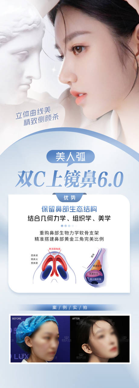 医美隆鼻长图
