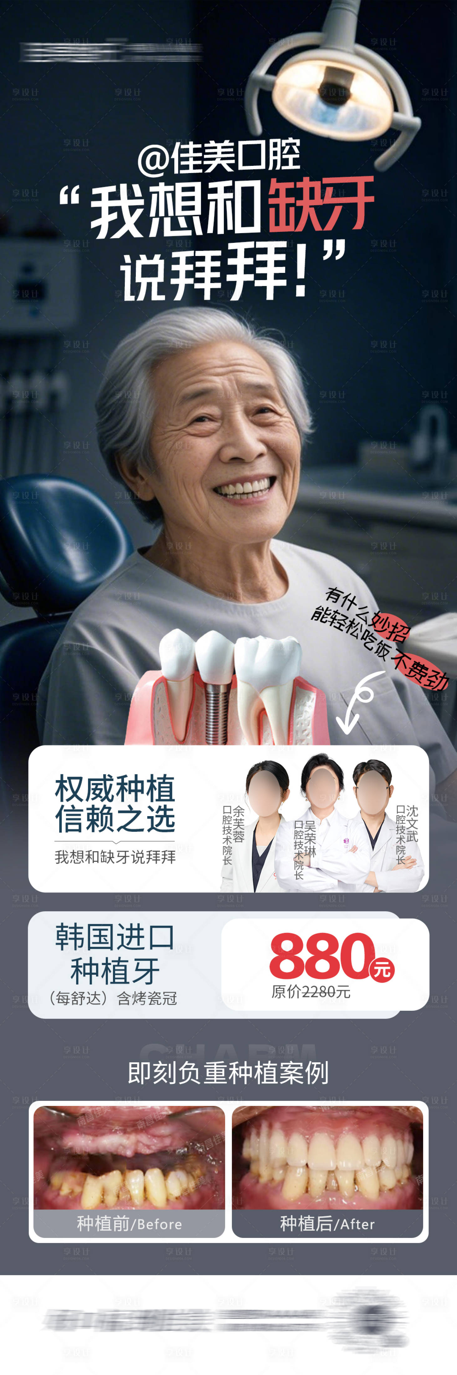源文件下載【享設計】搜索編號：42350030398031672【口腔種植牙長圖】