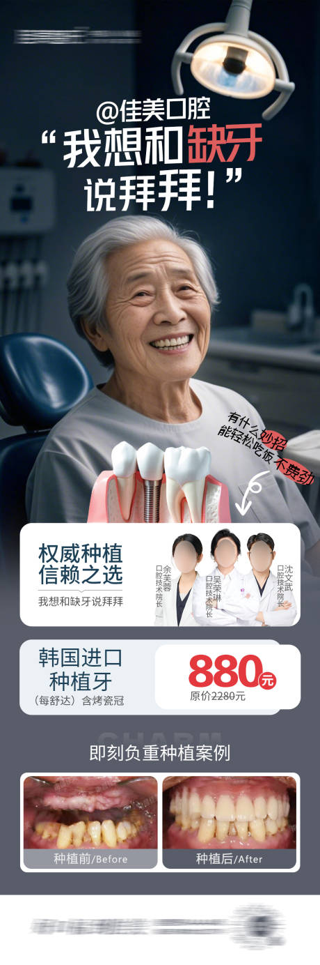 口腔种植牙长图