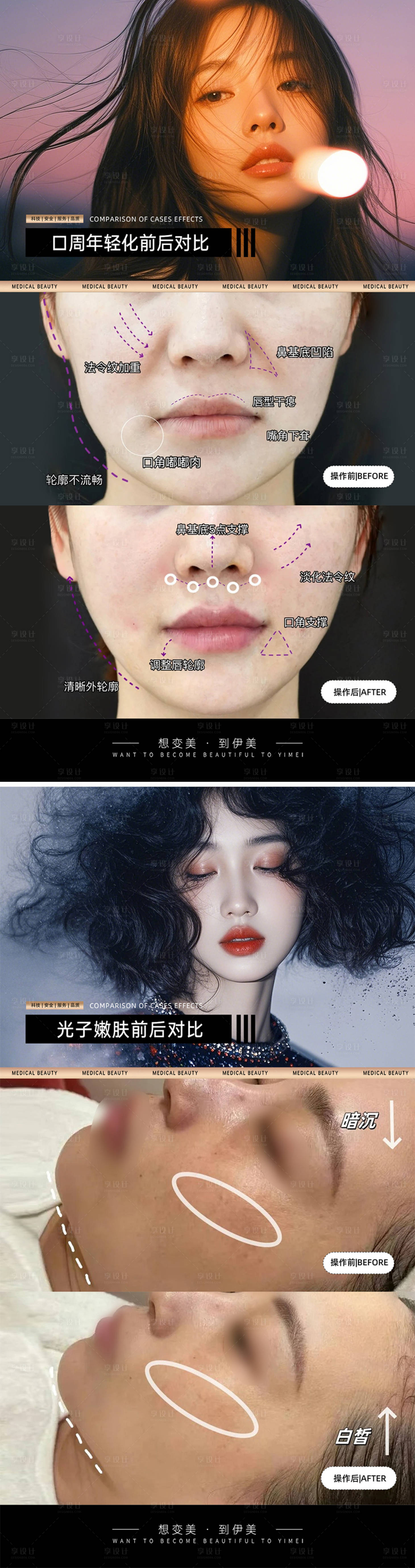 源文件下載【享設計】搜索編號：80300030470797410【醫美案例對比模板】