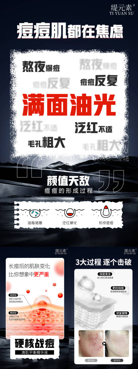 源文件下载【祛痘宣传海报】编号：42370030036172060