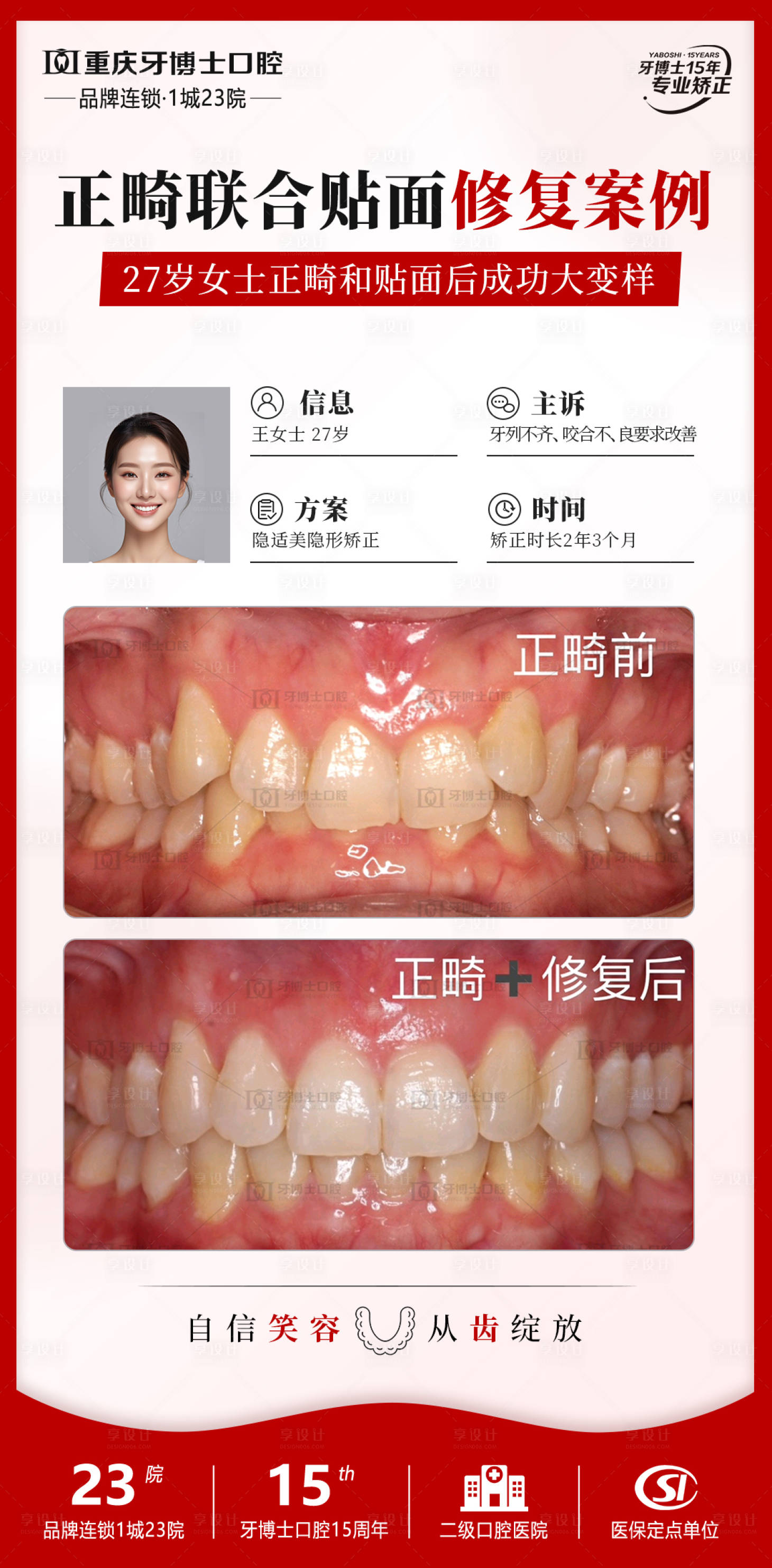 源文件下载【享设计】搜索编号：75230029991856885【口腔正畸案例海报】