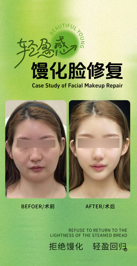 馒化脸修复案例海报