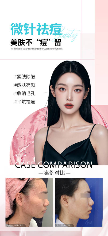 源文件下载【微针祛痘医美海报】编号：61950029917123447