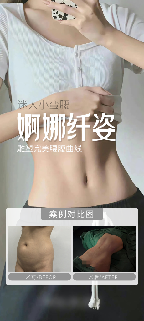 源文件下载【医美腰腹案例简约海报】编号：52340030060844995