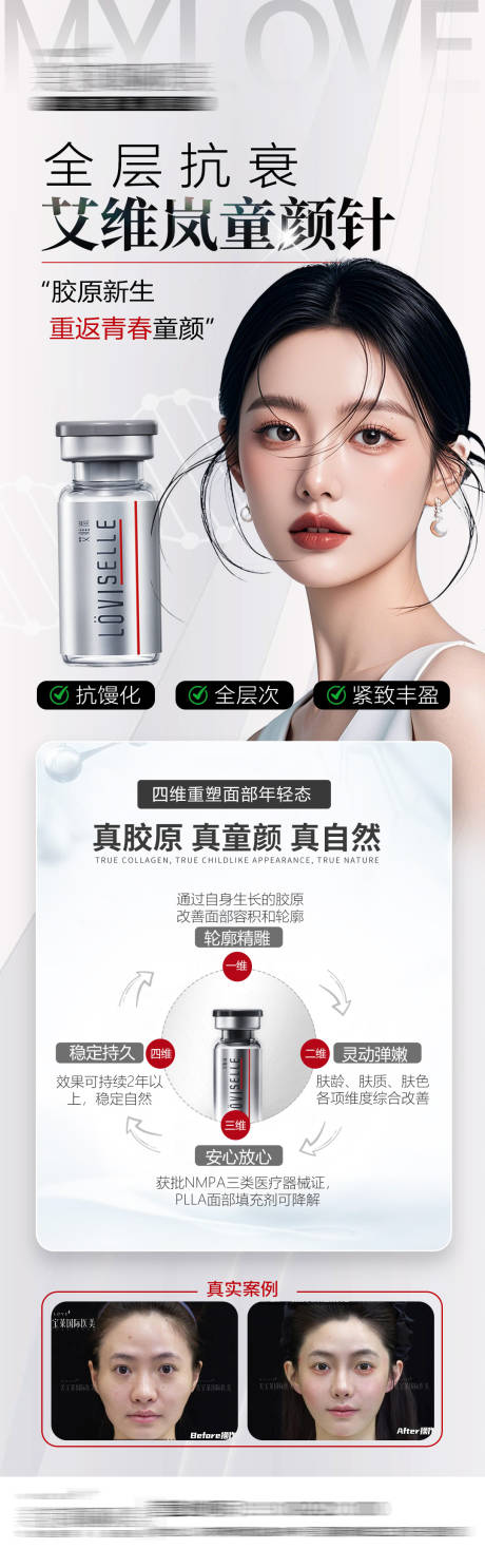 医美艾维岚童颜针海报