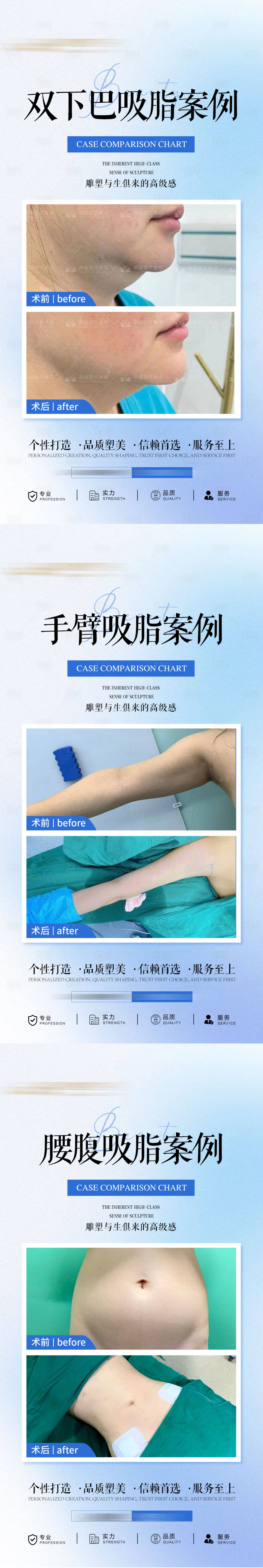 源文件下載【醫美吸脂案例系列海報】編號：96190030118063544