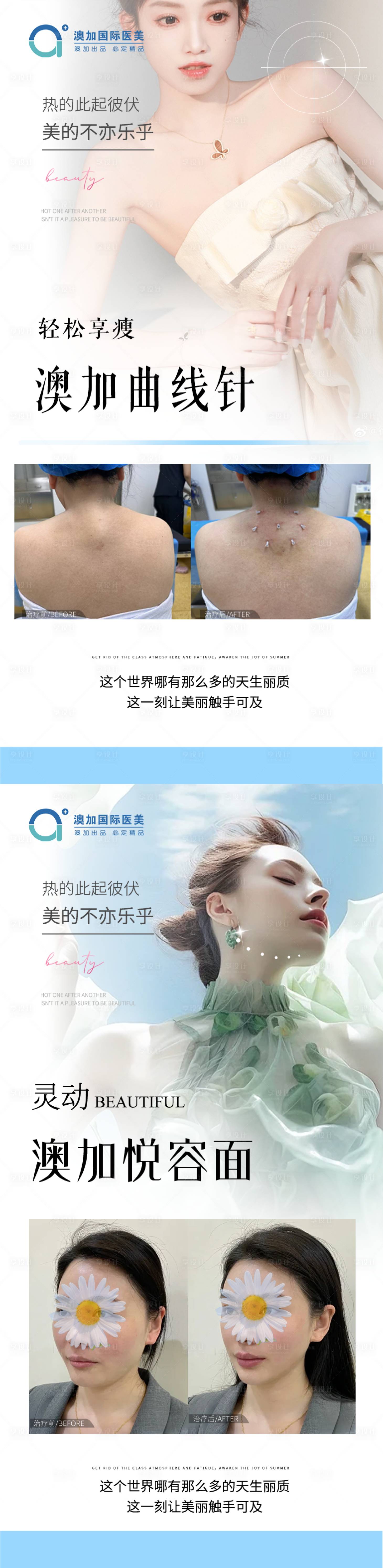 源文件下載【享設計】搜索編號：82040029928579731【醫美整形案例海報】