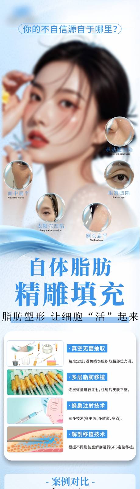 源文件下载【自体脂肪填充】编号：23260030111556531