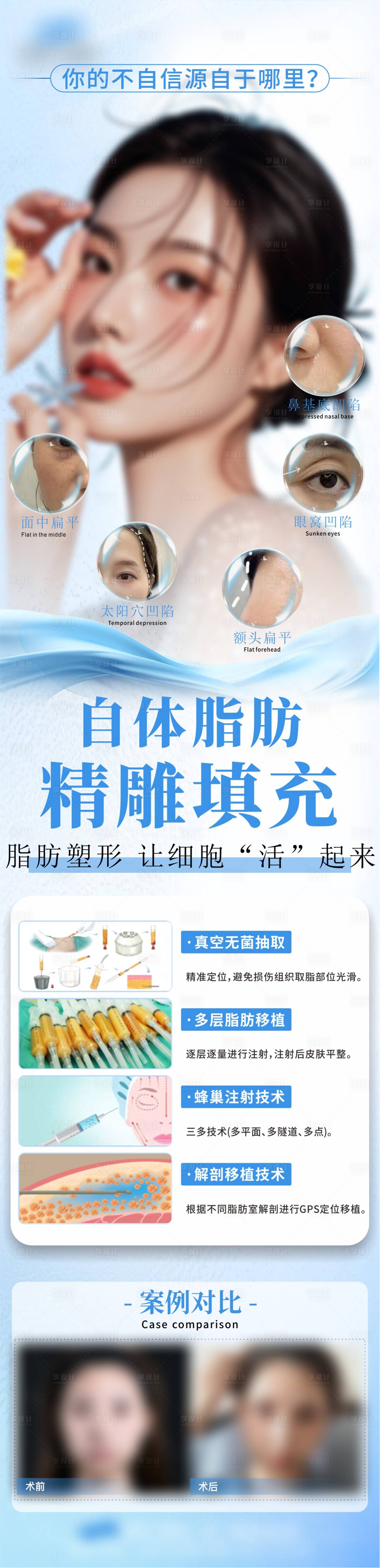 源文件下載【享設(shè)計】搜索編號：23260030111556531【自體脂肪填充】