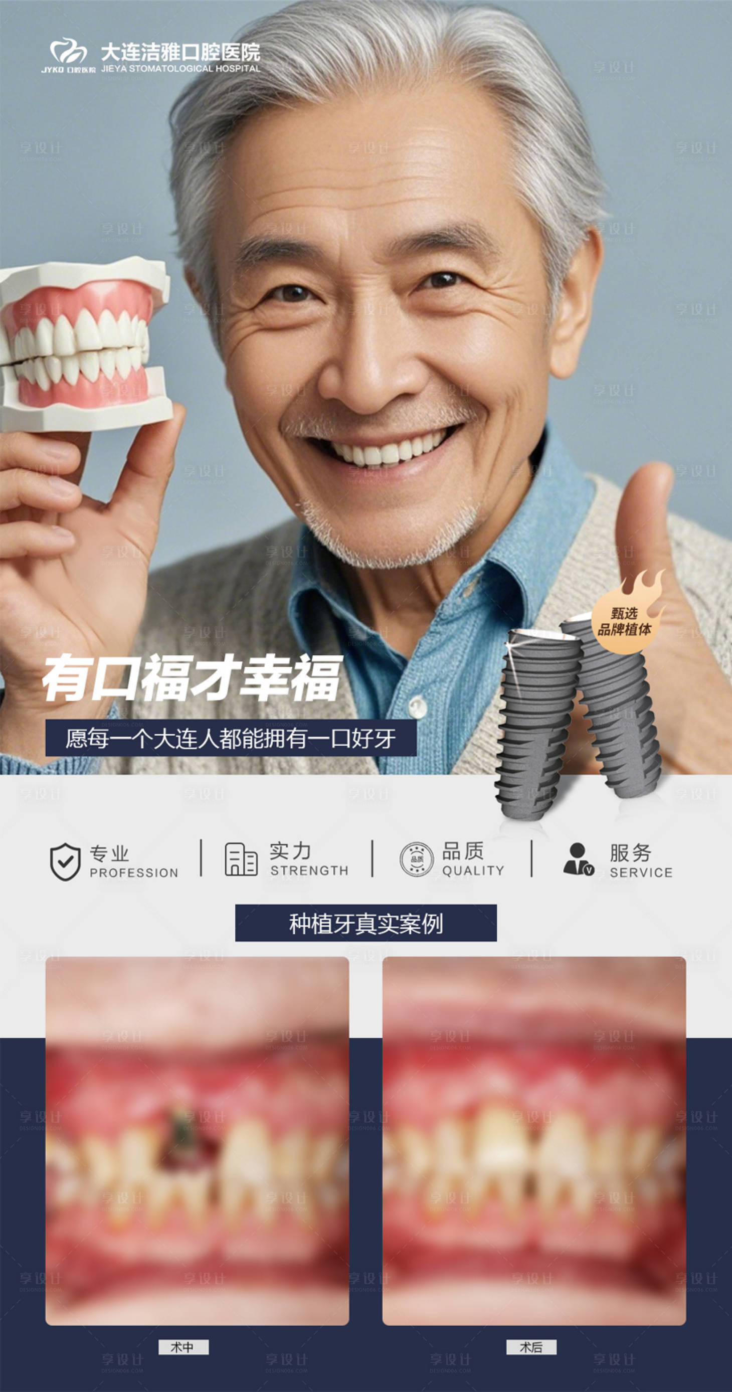 源文件下載【享設計】搜索編號：41300030274634194【口腔種植牙案例對比海報】