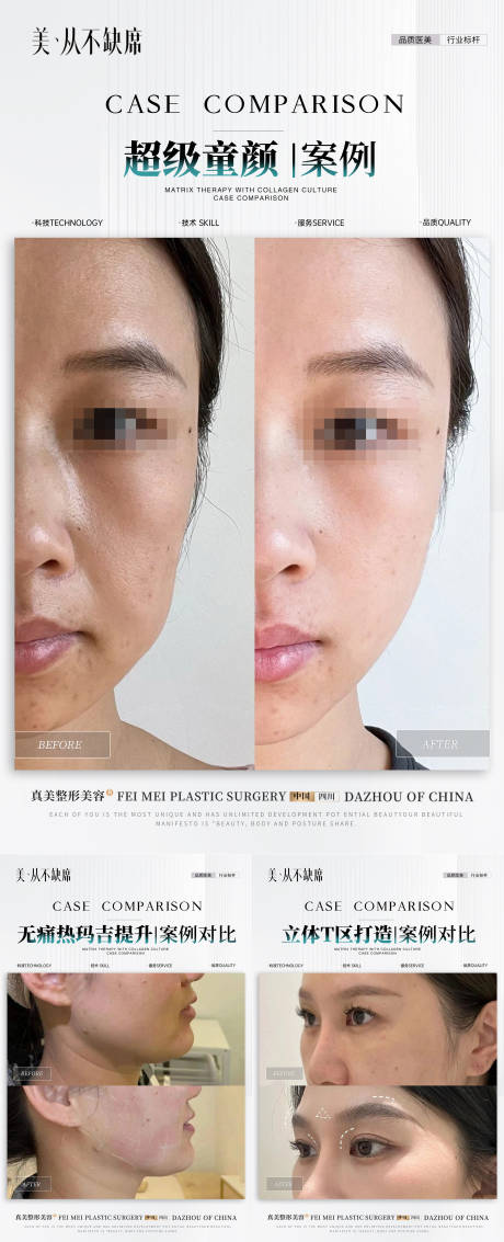 源文件下载【医美抗衰案例对比】编号：53940029960091738
