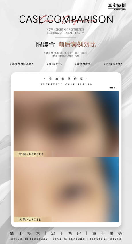 源文件下载【享设计】搜索编号：23760030086285913【案例对比】