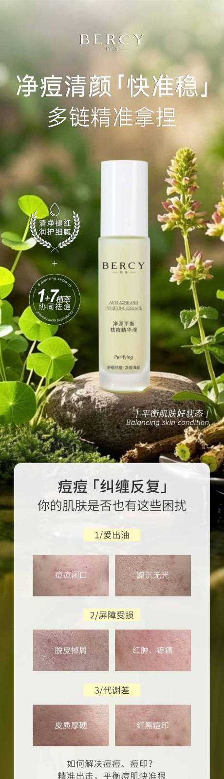 源文件下载【电商详情页祛痘精华祛痘产品】编号：63420030245752869