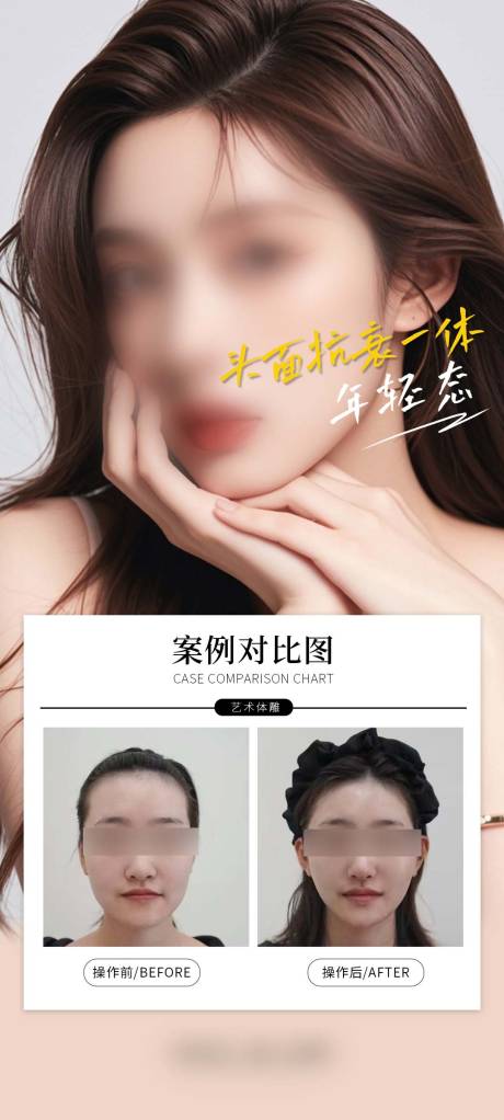 源文件下载【医美V脸案例海报】编号：30680030242591216