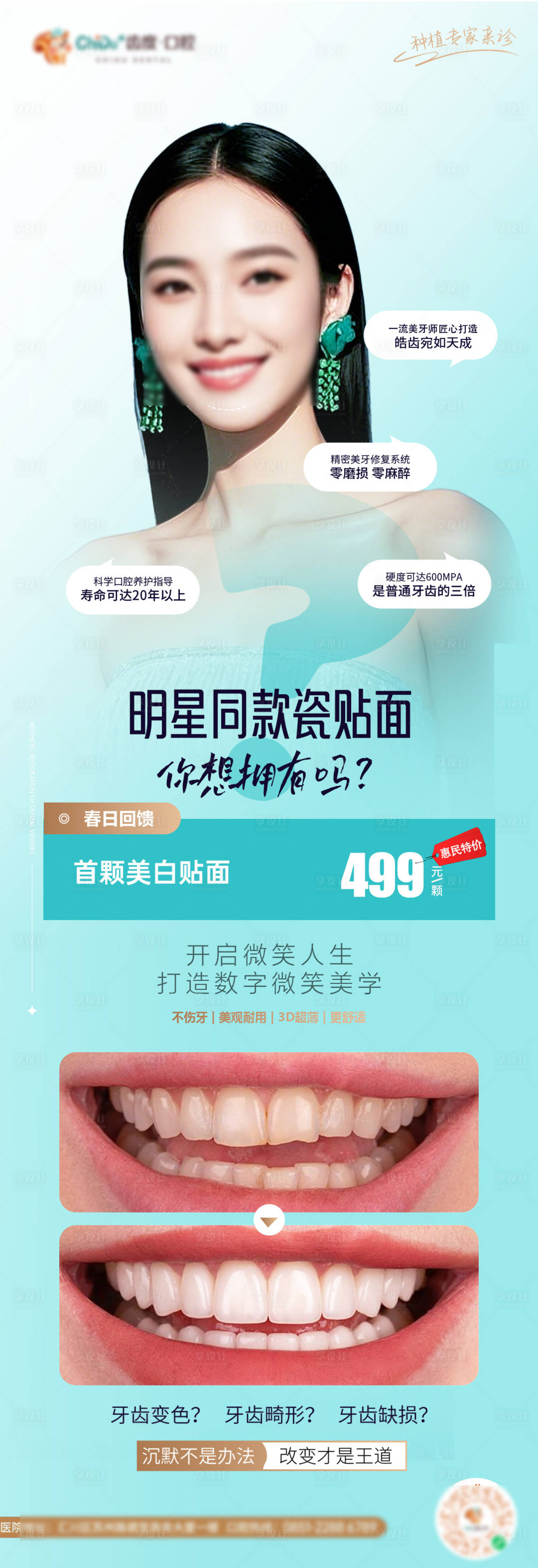源文件下載【享設計】搜索編號：20910030218722279【牙齒貼面案例對比】