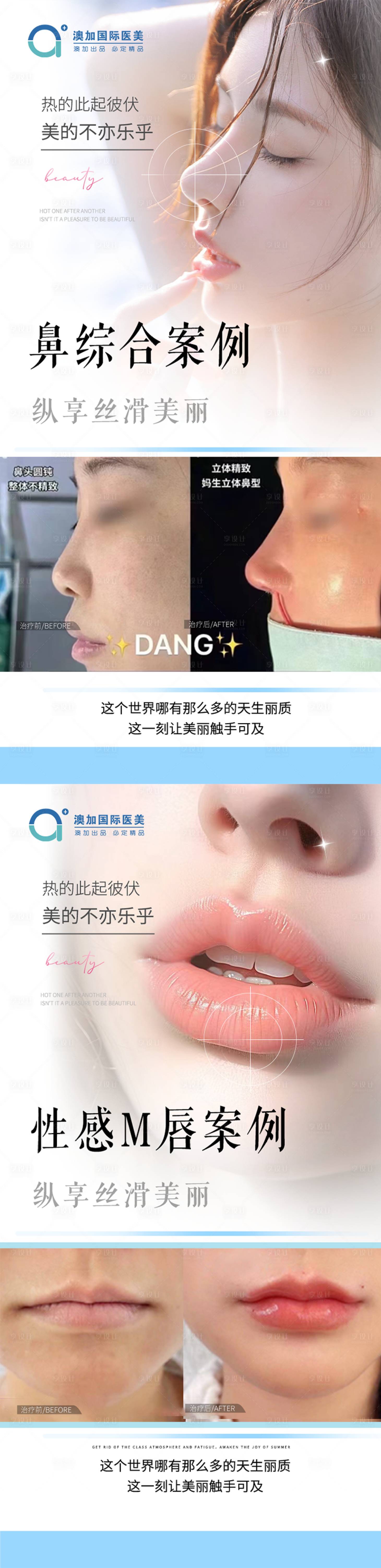 源文件下载【享设计】搜索编号：98130030070974093【整形案例】