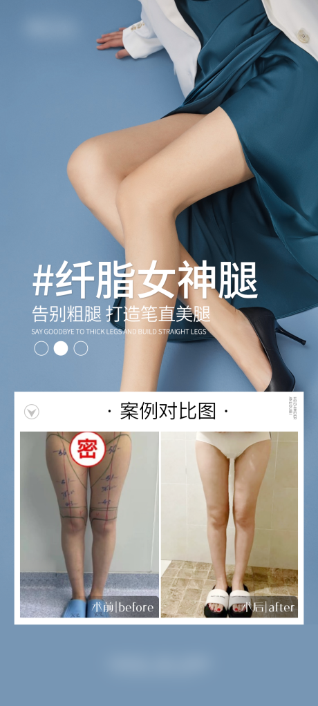 源文件下载【医美长腿案例海报】编号：24590030113799155