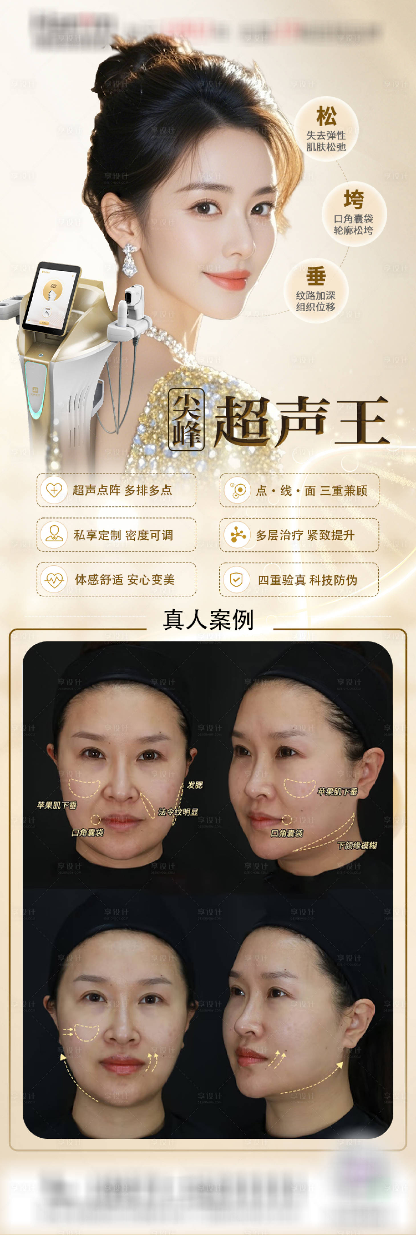 源文件下载【享设计】搜索编号：62180029963434725【医美超声王海报】
